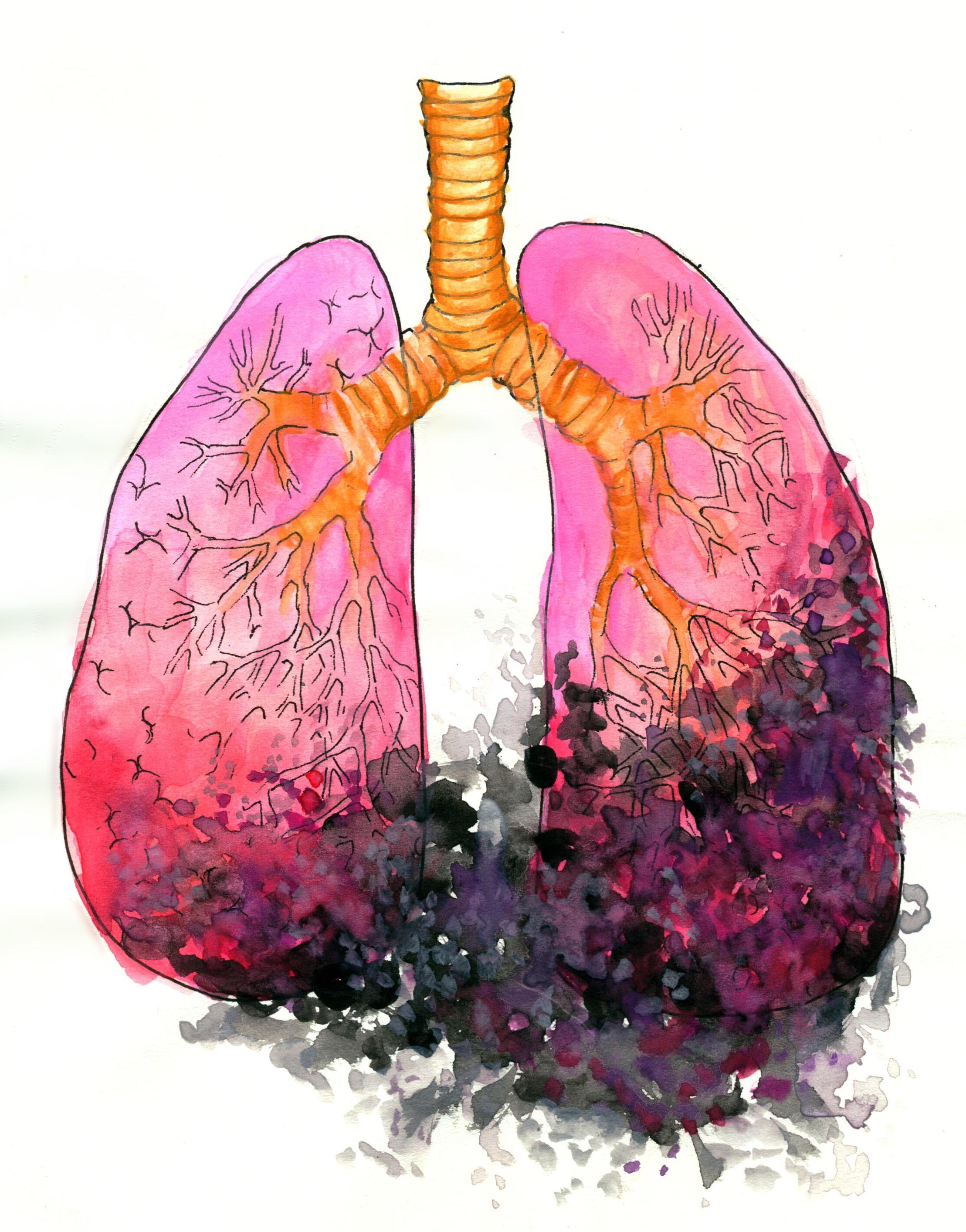 Lungs Drawing At Paintingvalley Explore Collection Of Lungs Drawing