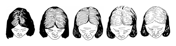 600x157 The Female Pattern Hair Loss Review Of Etiopathogenesis - 5 Point Crown Drawing