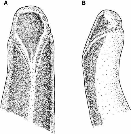 455x465 Amphiporus Rectangulus Sp Nov - A Drawing