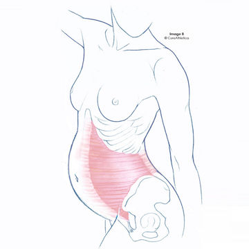 360x360 the deep core why it matters and how to strengthen it fit - Abdomen Drawing