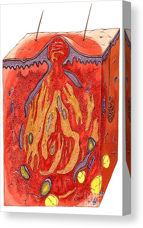 463x740 Acne Drawing Canvas Print Canvas Art - Acne Drawing