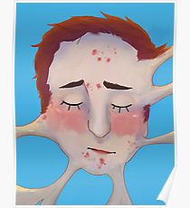 210x230 Acne Drawing Posters Redbubble - Acne Drawing