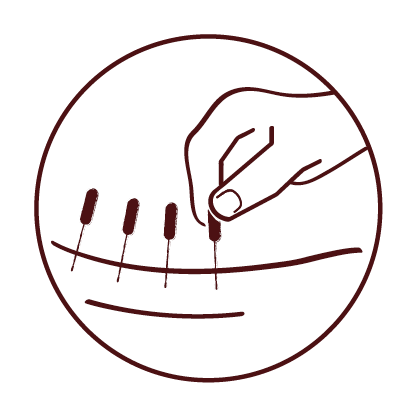 Acupuncture Drawing