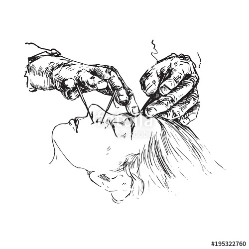 500x500 doctor insert acupuncture needles in beautiful woman face, hand - Acupuncture Drawing