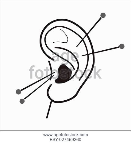 427x466 Drawing Acupuncture Stock Photos And Images Age Fotostock - Acupuncture Drawing
