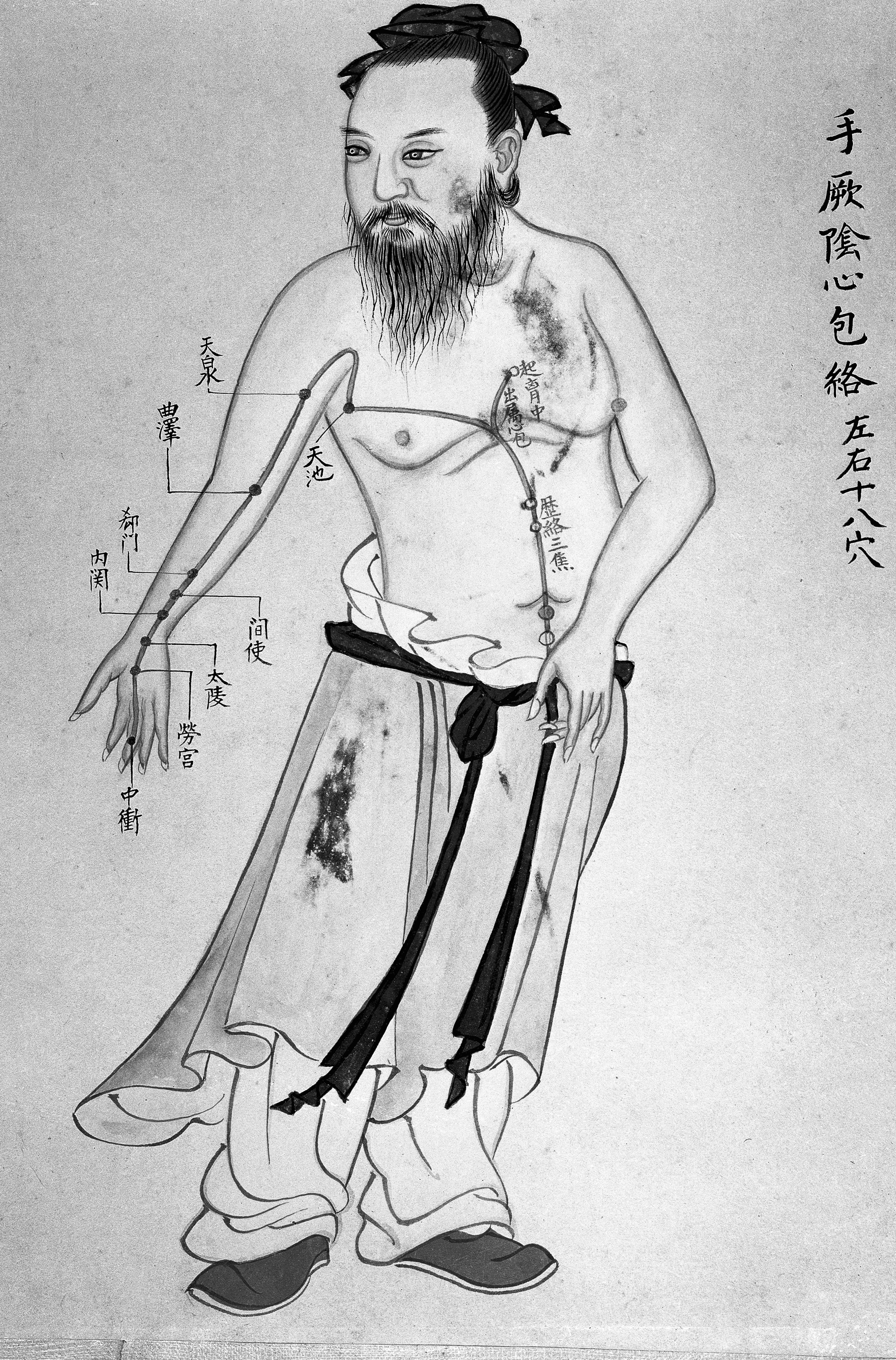 2655x4030 Filechinese Acupuncture Chart, Century Wellcome - Acupuncture Drawing