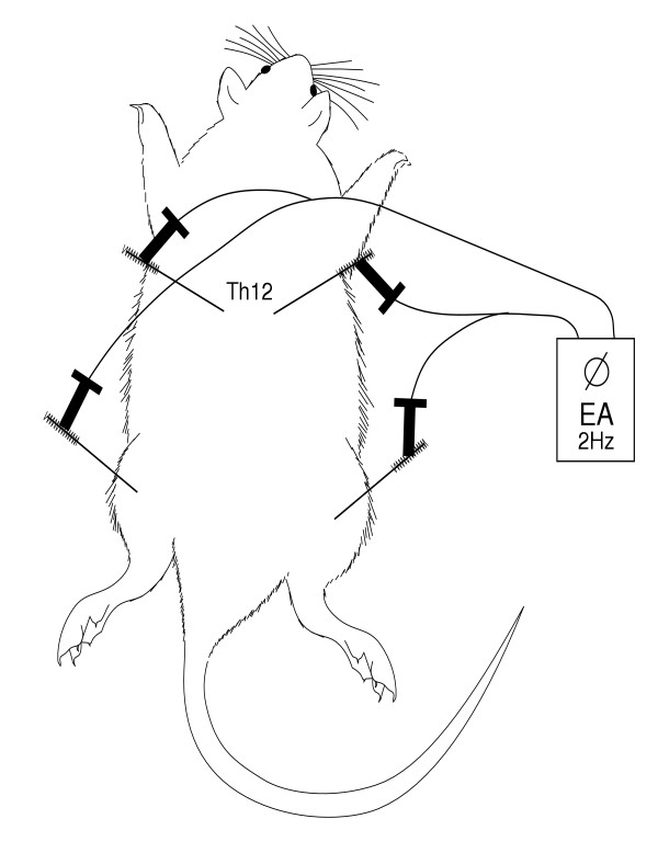600x778 Schematic Drawing Of The Placement And Stimulation - Acupuncture Drawing