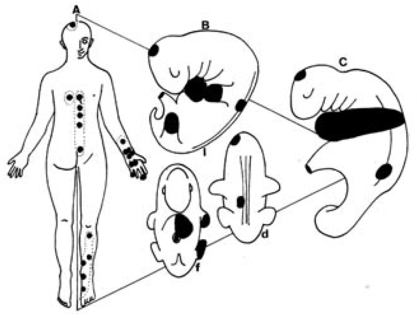 851x649 the strange circle in kidney channel - Acupuncture Drawing