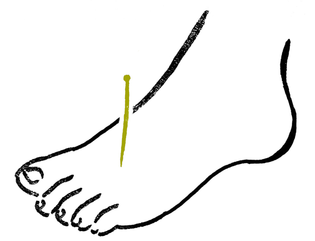 627x480 welcome to acupuncture acutherapy council - Acupuncture Drawing