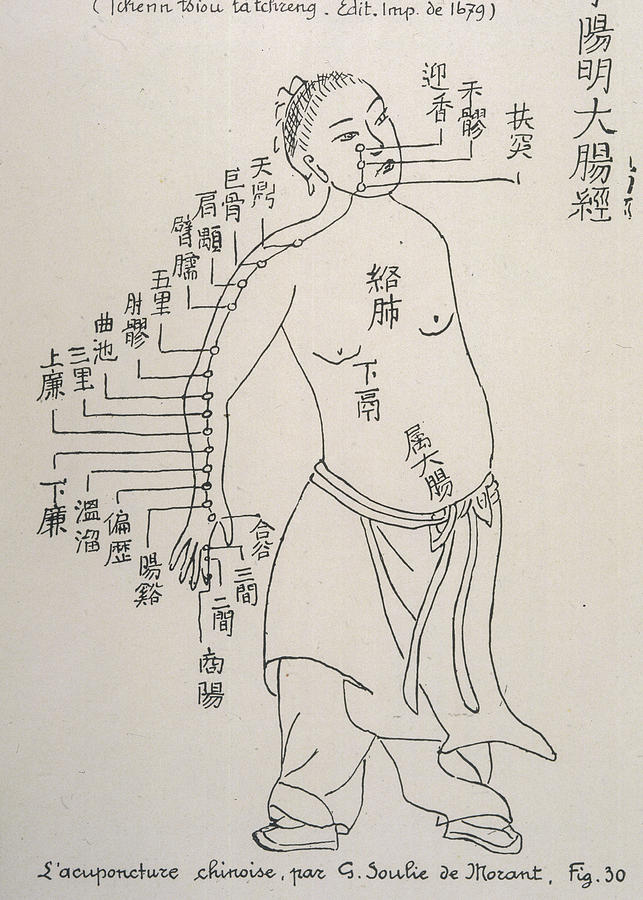 643x900 Acupuncture The Meridian Of The Large Drawing - Acupuncture Drawing
