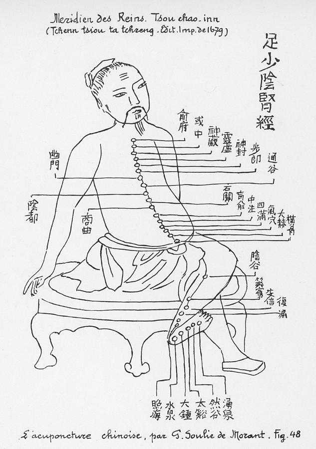 Acupuncture Drawing At PaintingValley.com | Explore Collection Of ...