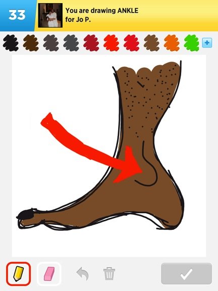 432x576 Ankle Drawings - Ankle Drawing