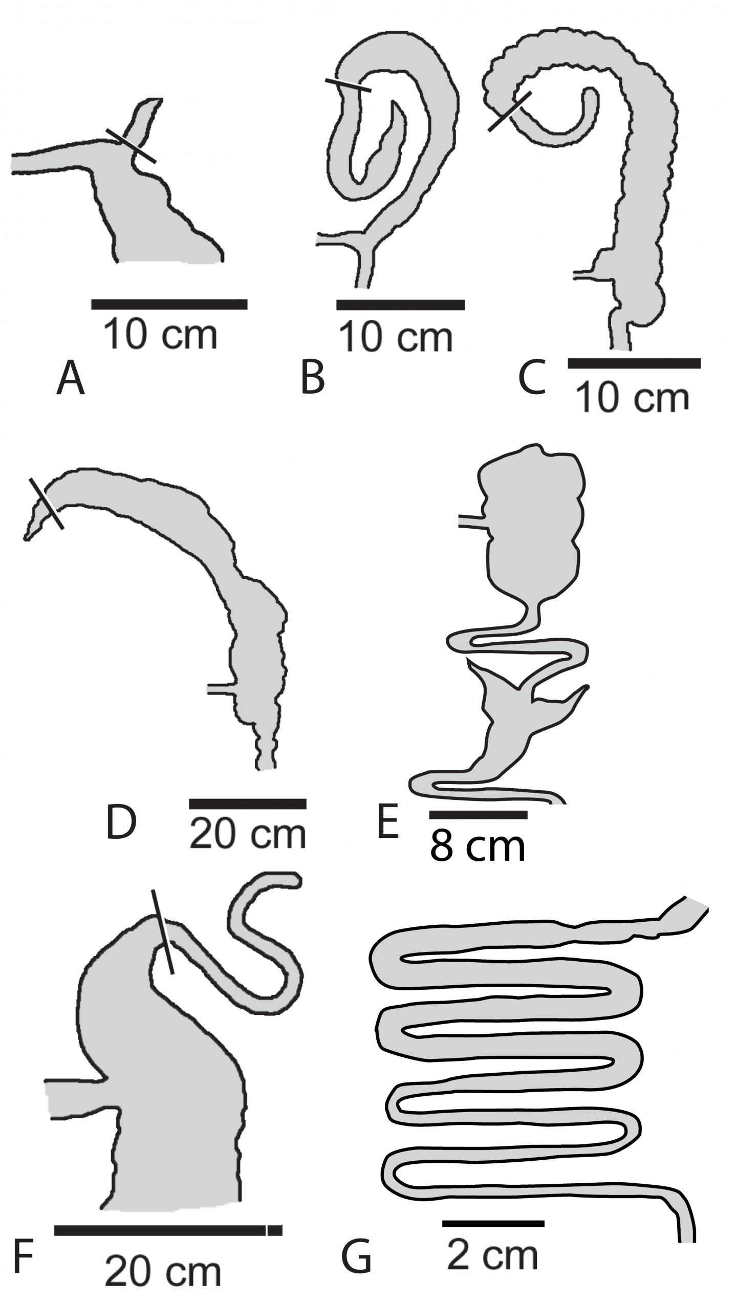1440x2544 new research suggests appendix may have important function - Appendix Drawing