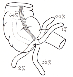 Appendix Drawing at PaintingValley.com | Explore collection of Appendix ...