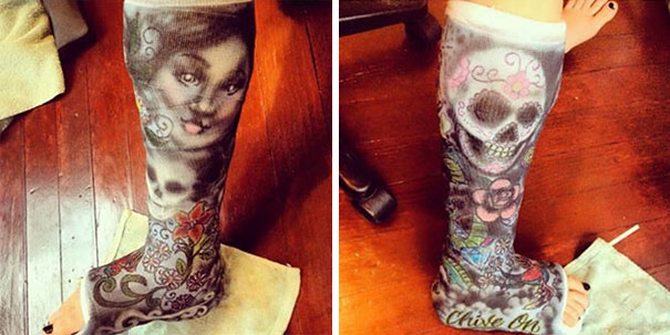 605x303 Creative Cast Art That Makes The Best Of A Bad Situation Bored Panda - Arm Cast Drawing