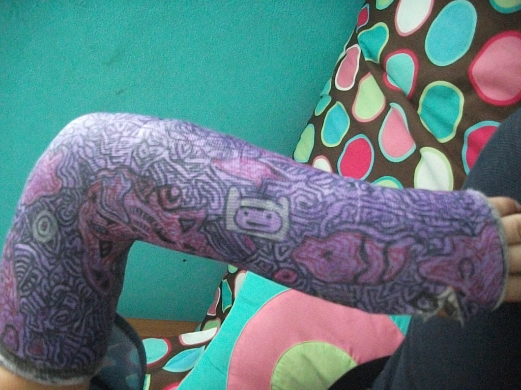 1024x768 The World's Newest Photos - Arm Cast Drawing