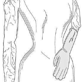 276x276 The Cast Of Woman In A Long With The Easter Island - Arm Cast Drawing