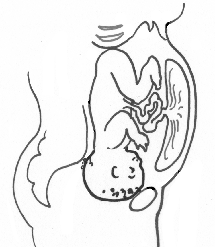 750x861 anterior placenta - Baby In Womb Drawing