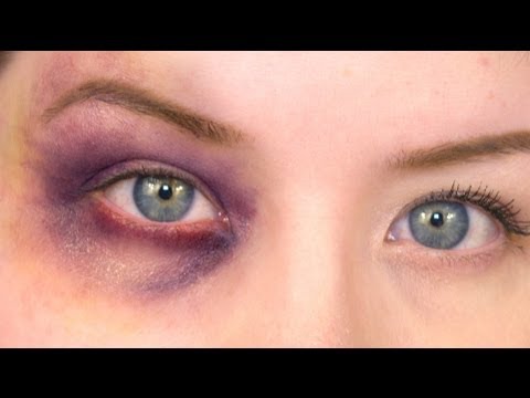 480x360 Fx Makeup Series Black Eye - Black Eye Drawing