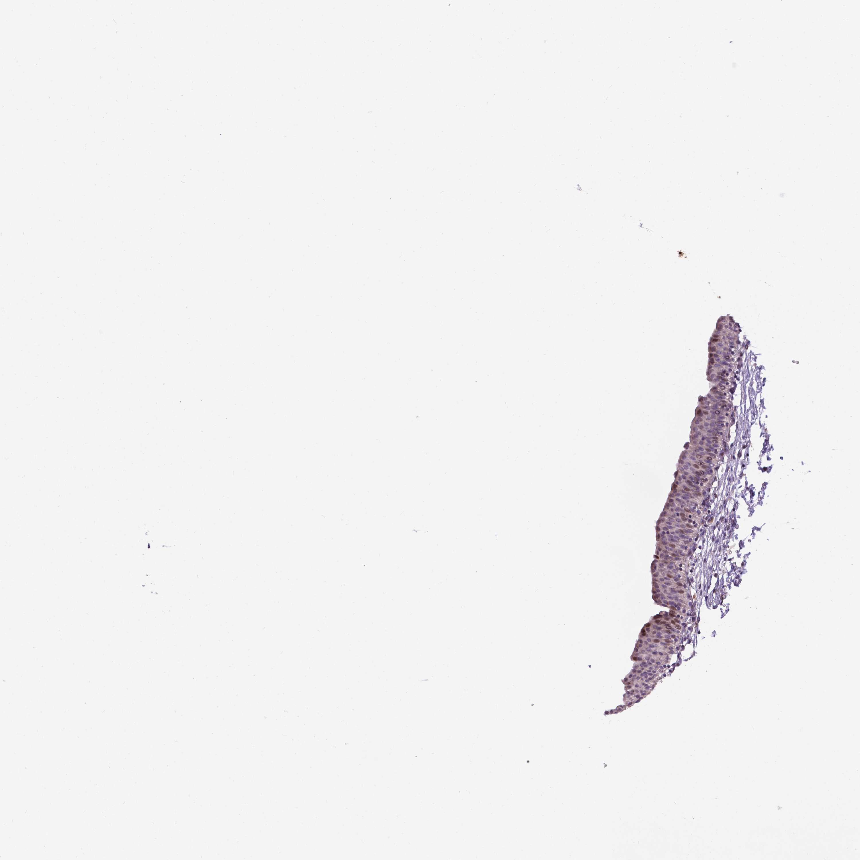 3000x3000 tissue expression - Bladder Drawing