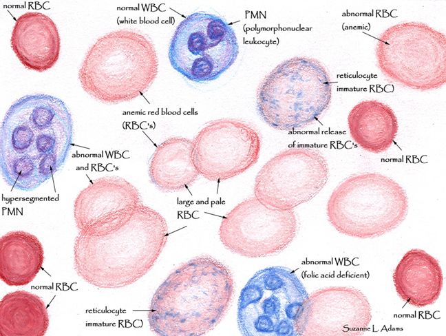 When to See a Hematologist for Anemia Blood Cell Drawing at PaintingValley com Explore 