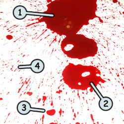 250x250 How To Draw Blood - Blood Drawing