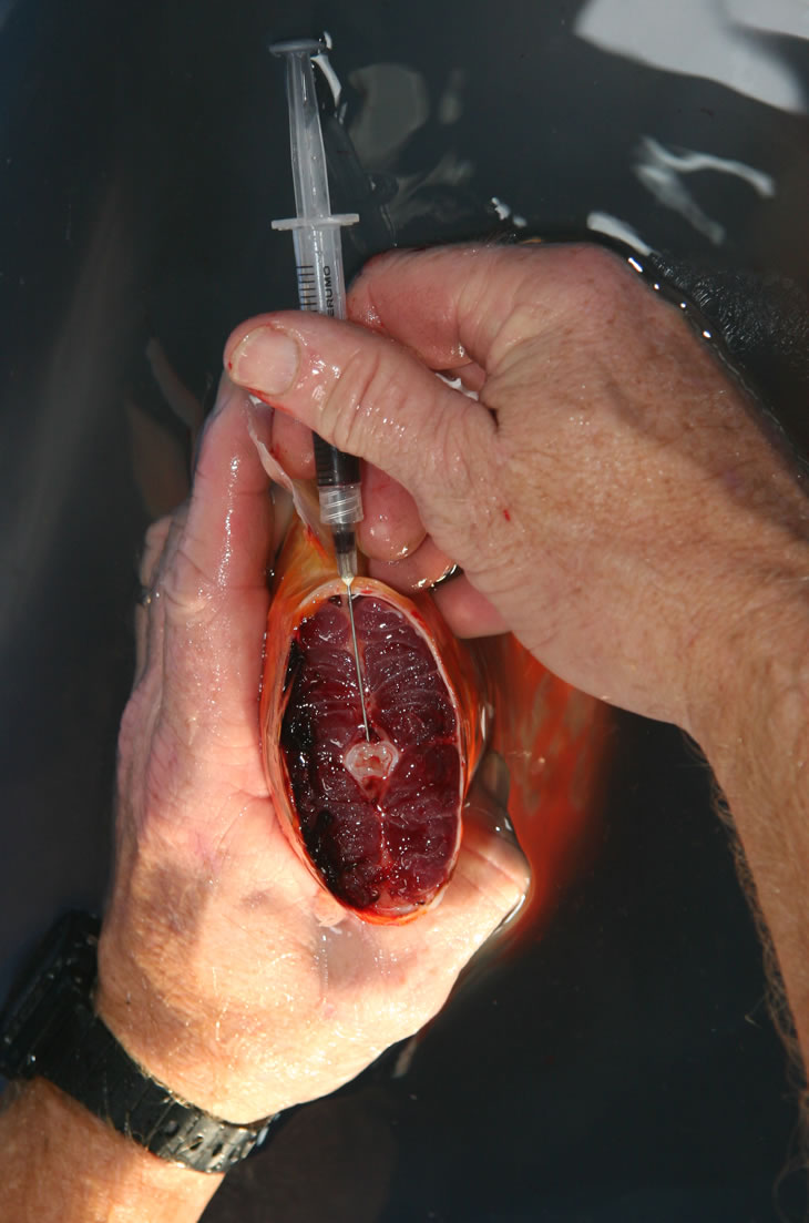 730x1103 Obtaining Blood For Serological Testing - Blood Drawing