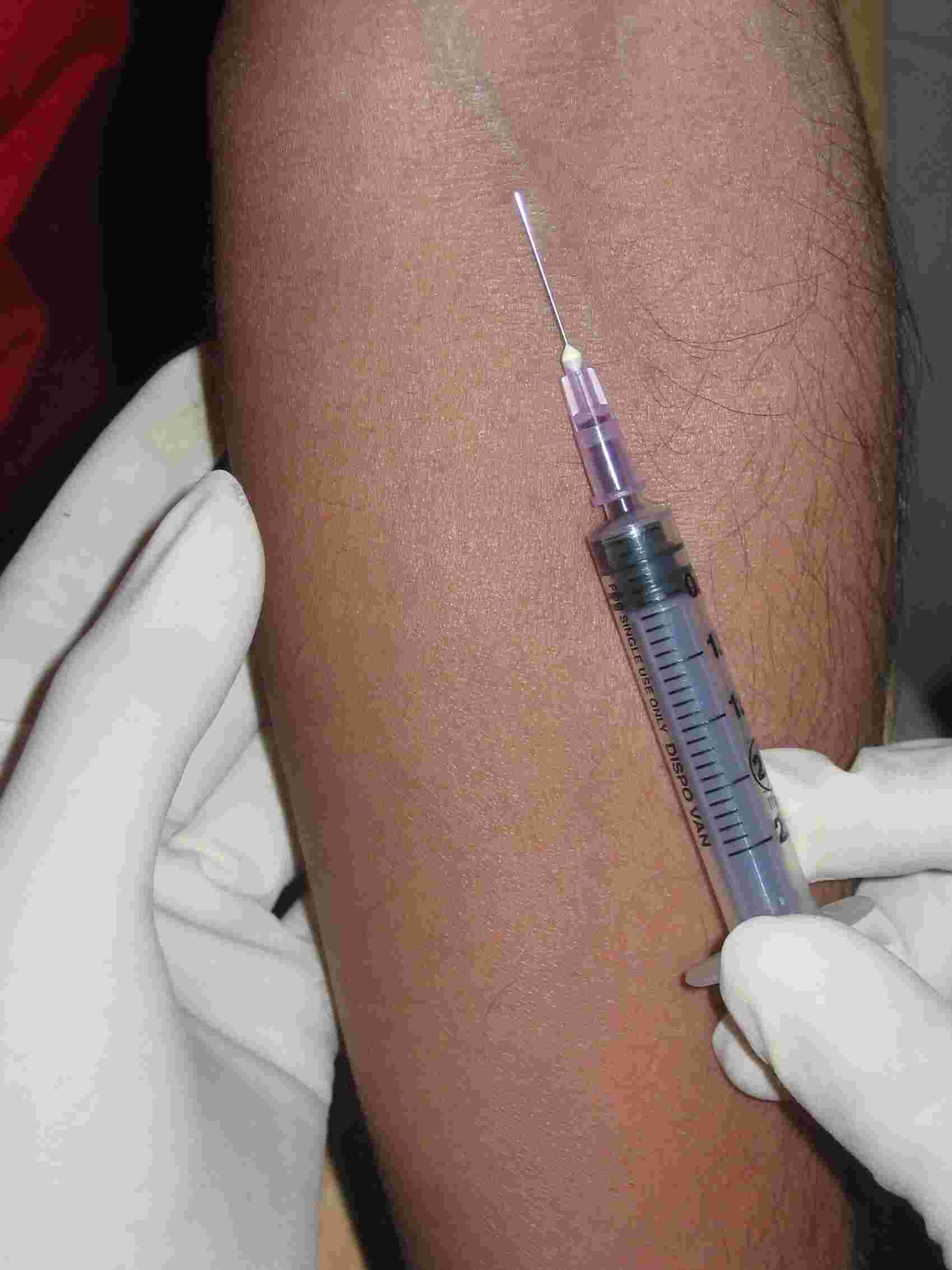 1699x2266 picture tutorial phlebotomy equipment - Blood Drawing