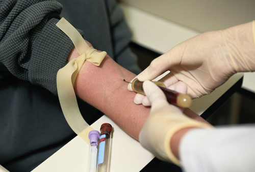 500x336 The Dwi Blood Draw Process In Texas May Be Flawed - Blood Drawing