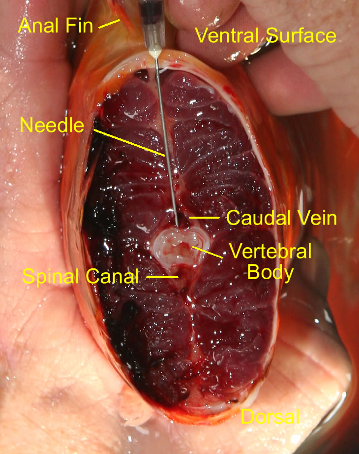 730x922 Obtaining Blood For Serological Testing - Blood Drawing Reference