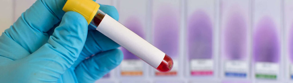 1024x293 About Us Lifelabs - Blood Drawing Reference