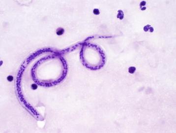 358x270 Blood Tissue Nematodes - Blood Tissue Drawing