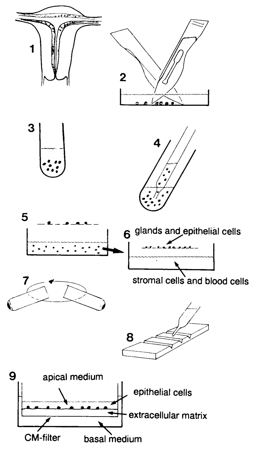 850x1518 Schematic Drawing Of The Separation Procedure The Successive - Blood Tissue Drawing