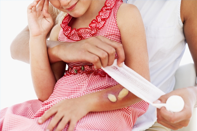 800x534 how to use a boil drawing salve healthy living - Boil Drawing