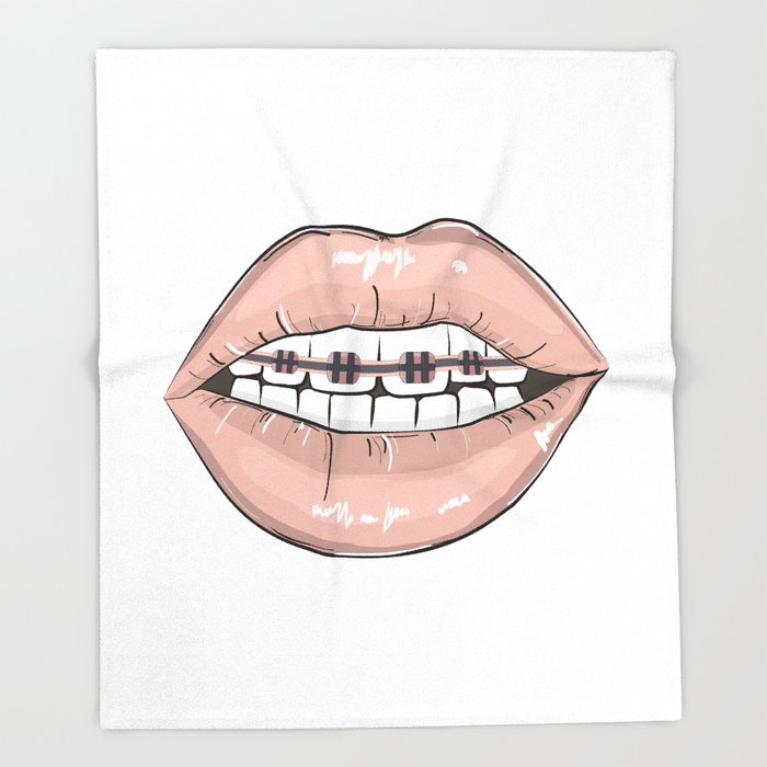 Braces Drawing at Explore collection of Braces Drawing