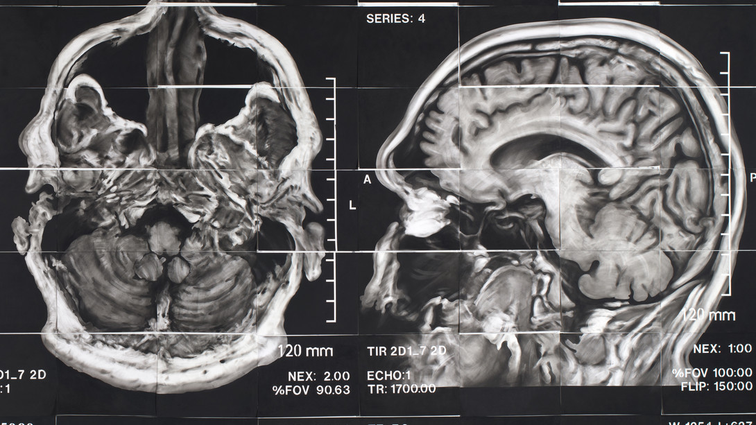 1090x613 James Drake Anatomy Of Drawing And Space - Brain Anatomy Drawing