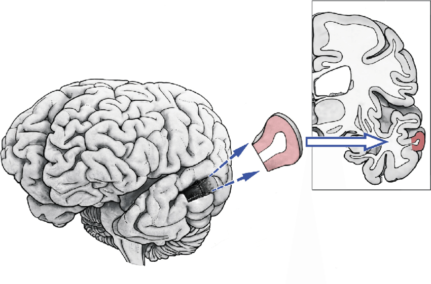 850x561 Schematic Drawing Of The Dissected Human Brain Tissue Probes - Brain Drawing Images