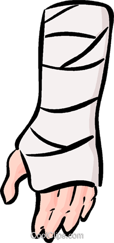 225x480 Collection Of Free Cast Drawing Arm Download On Ui Ex - Broken Arm Cast Drawing