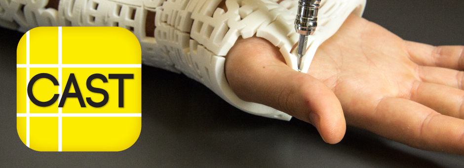 940x340 Hashcast Printed Cast Arm Cast Design Project - Broken Arm Cast Drawing