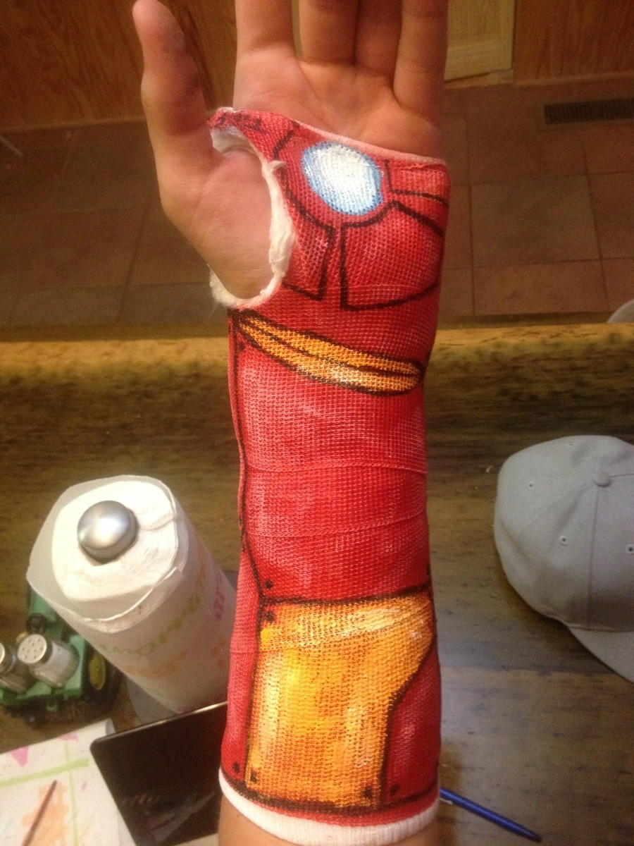 900x1200 Iron Man Cast Turns A Broken Wrist Into A Good Thing Fanboy Fashion - Broken Arm Cast Drawing