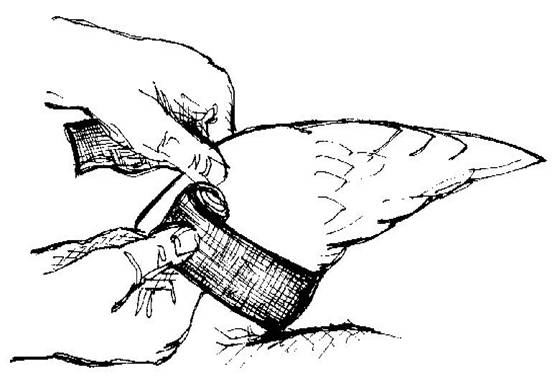 552x385 Broken Bone Drawing - Broken Bone Drawing