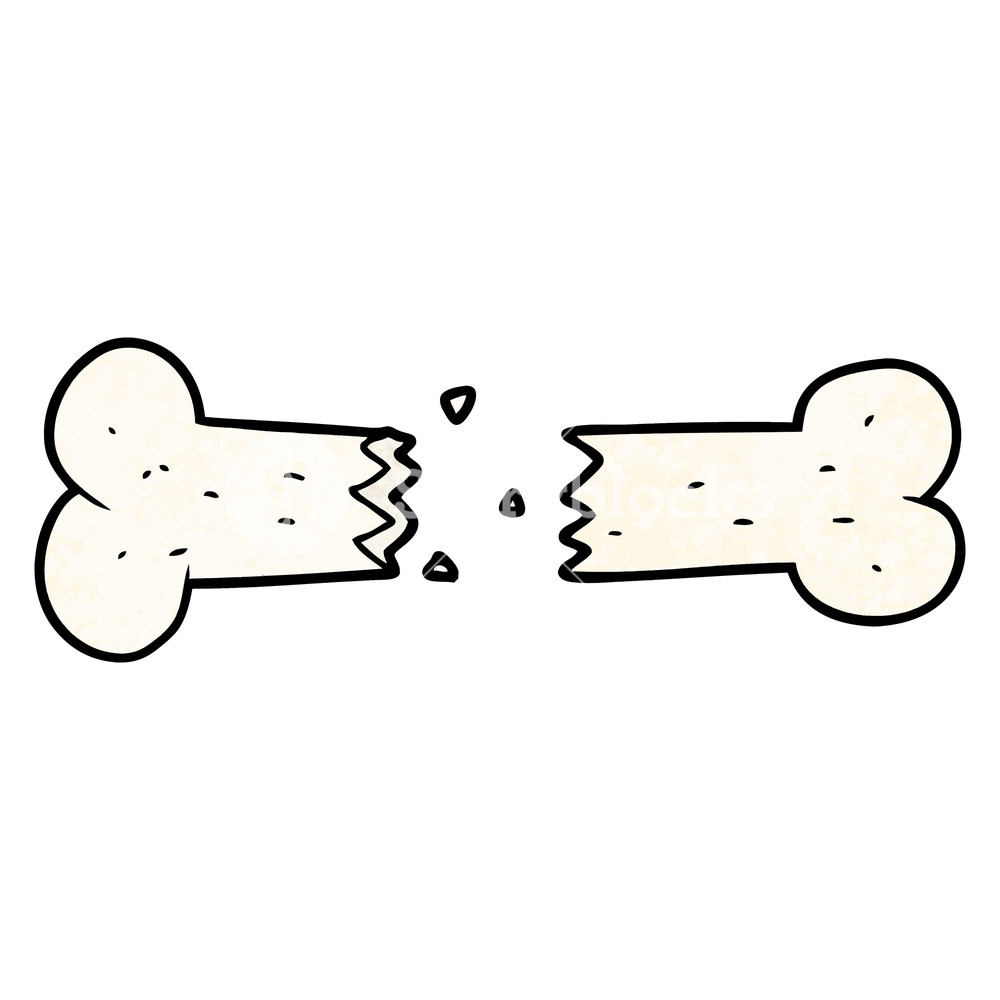1000x1000 Broken Bone Cartoon Royalty Free Stock Image - Broken Bone Drawing