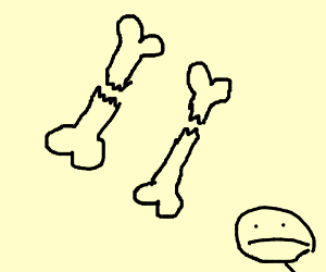 300x250 Broken Bones Drawing - Broken Bone Drawing