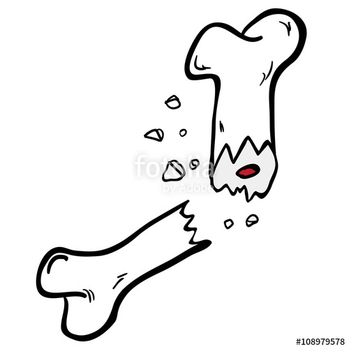 500x500 Freehand Drawn Cartoon Broken Bone Stock Image And Royalty Free - Broken Bone Drawing