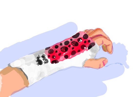 550x400 My Broken Hand A Technics Speedpaint Drawing - Broken Hand Drawing