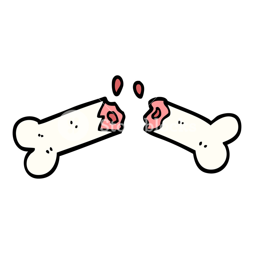 1000x1000 Hand Drawn Doodle Style Cartoon Broken Bone Royalty Free Stock - Broken Hand Drawing