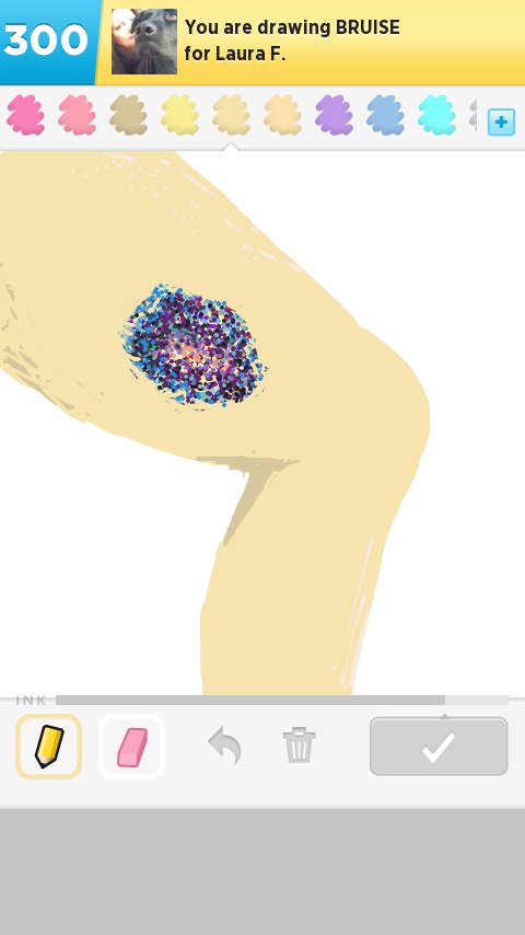 480x854 Bruise Drawings - Bruise Drawing