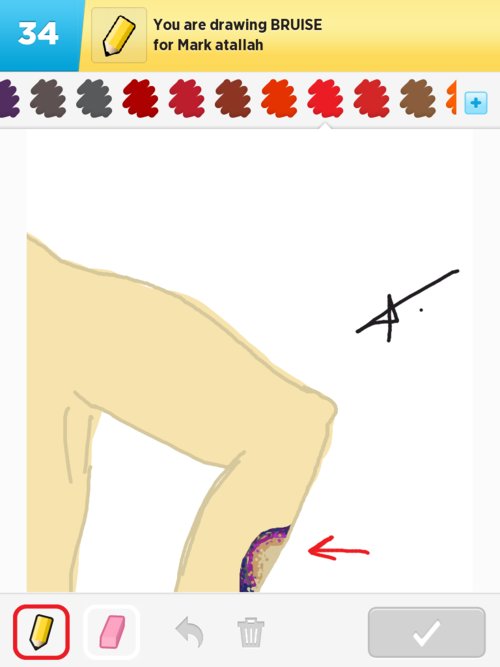 500x667 Bruise Drawings - Bruise Drawing