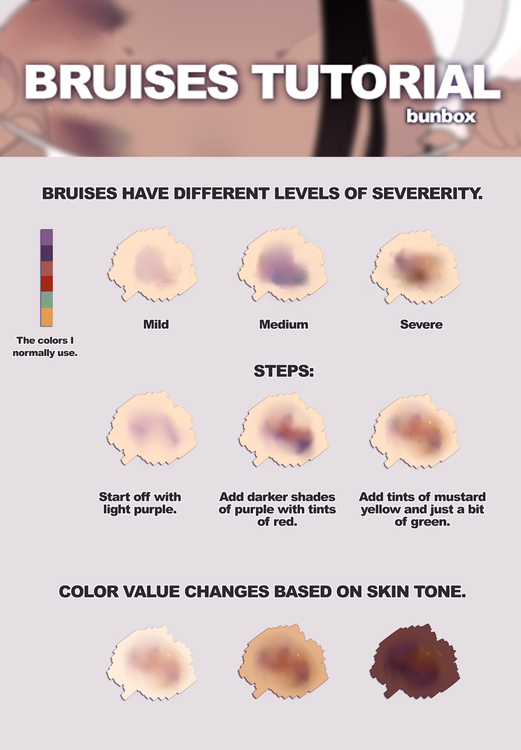 745x1072 Bruises Tutorial - Bruise Drawing