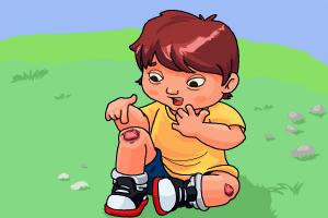 300x200 How To Draw Bruises - Bruise Drawing